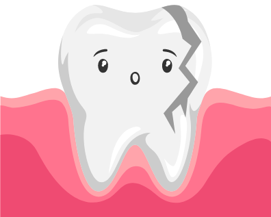 What Should I Do If I Chip My Tooth?