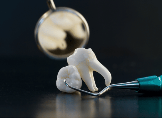 5 Tips for Healing After Wisdom Tooth Removal